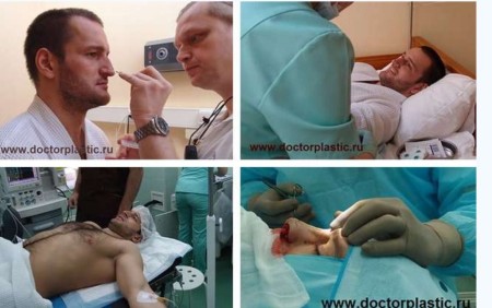 Благодаря DoctorPlastic Самсонов будет дышать