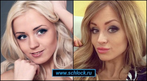 Увеличение губ на примере участниц проекта дом 2