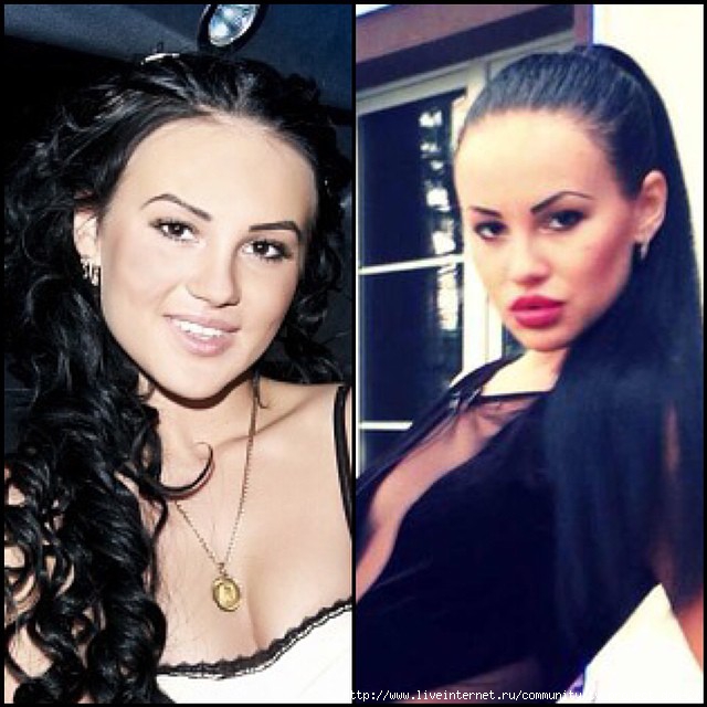 Таня Охулкова до пластики и после