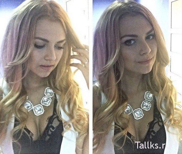 Кручинина пошла на поправку?! Кручинина пошла на поправку?!