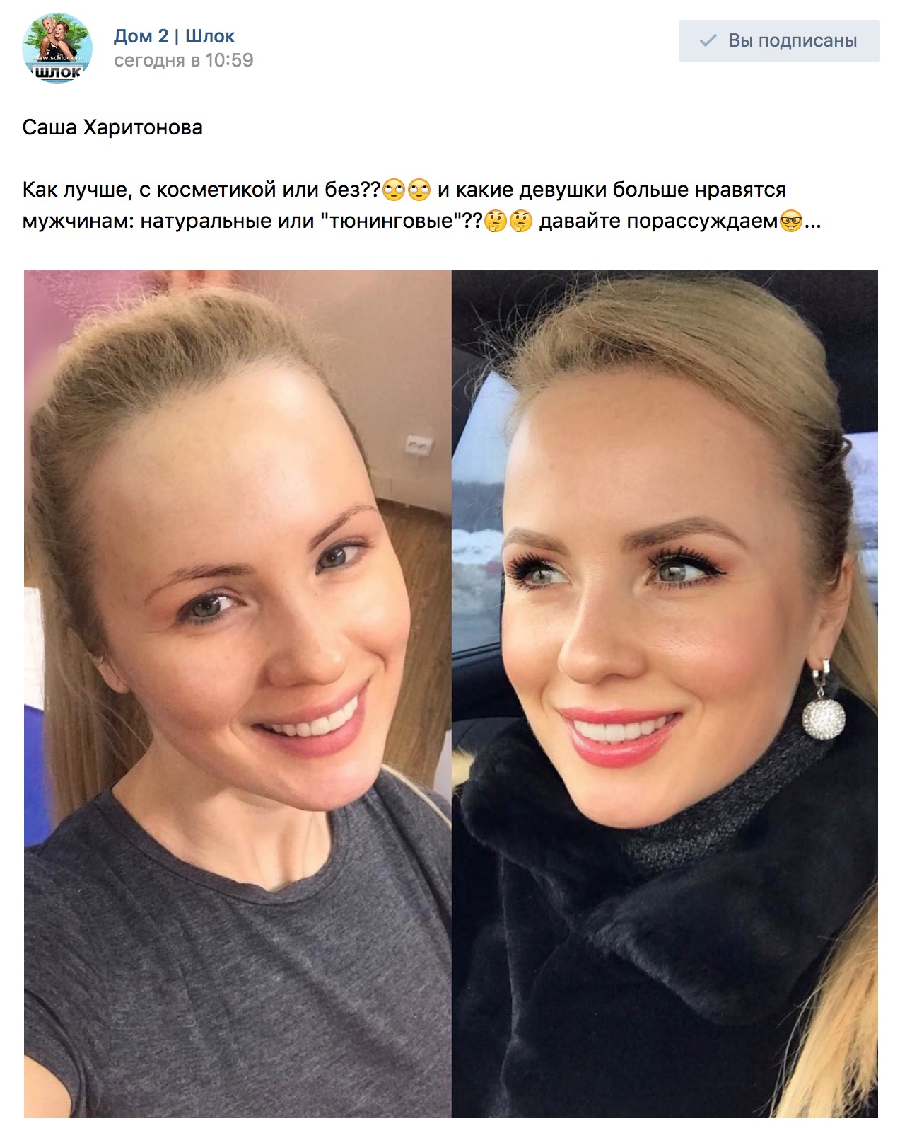 Саша Харитонова до и после пластики