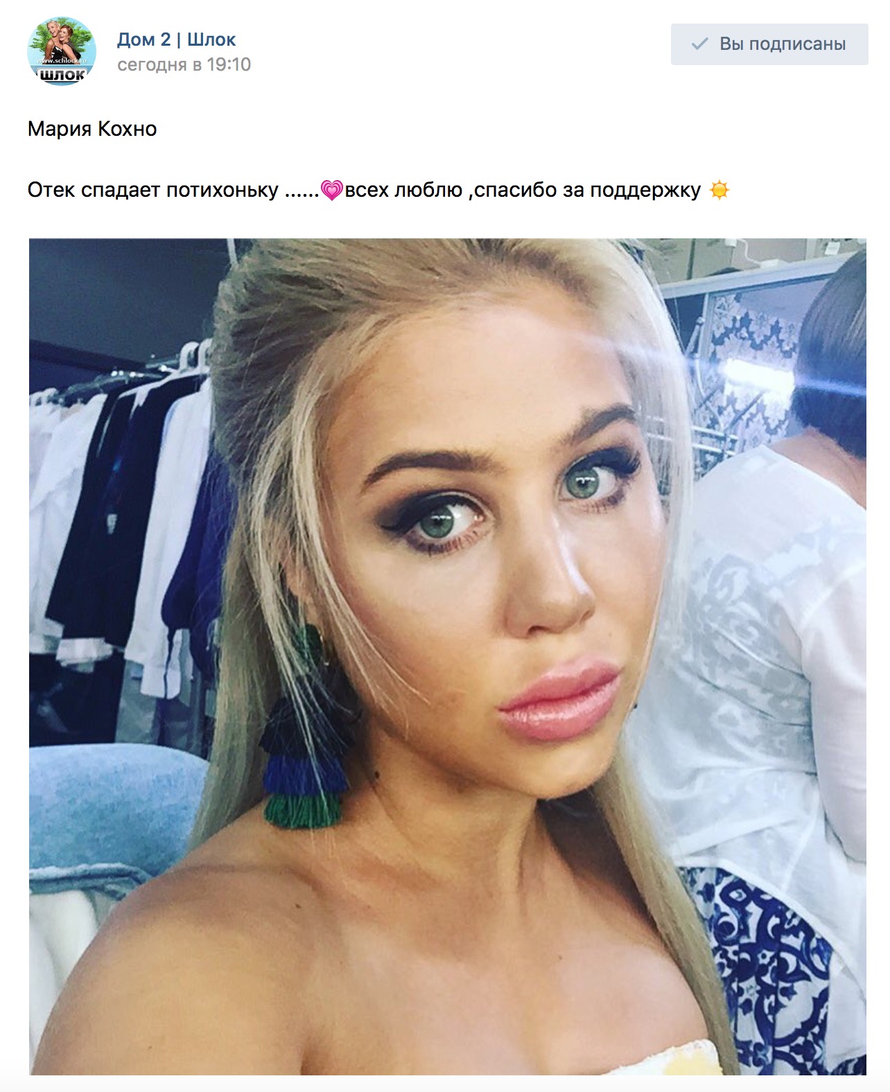 Отек спадает потихоньку
