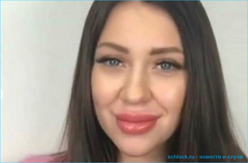 Алена Савкина неудачно изменила форму губ