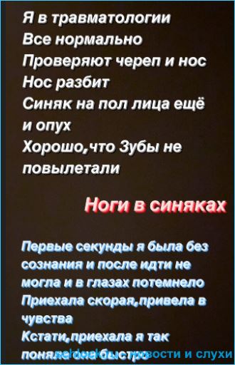 https://schlock.ru/wp-content/uploads/2020/12/xsshot-182.jpg.pagespeed.ic.XpRgV3TRTb.webp
