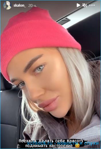 Екатерина Скалон пожаловалась на равнодушие Бабича