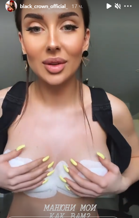 Татьяна Мусульбес уменьшила бюст, а Стецевьят хочет себе шестой размер Татьяна Мусульбес уменьшила бюст, а Стецевьят хочет себе шестой размер