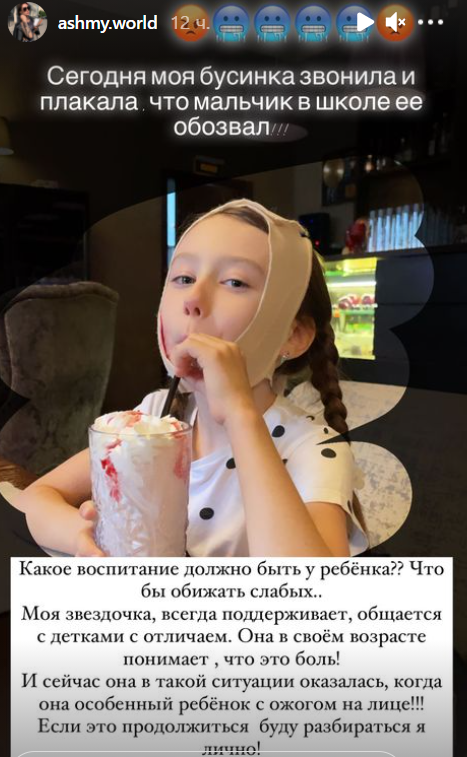 Дочь Алёны Ашмариной из-за ожога обижают в школе Дочь Алёны Ашмариной из-за ожога обижают в школе