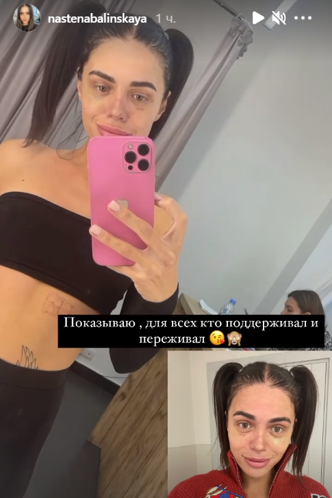 https://schlock.ru/wp-content/uploads/2021/09/x2021-09-07_15-18-30.png.pagespeed.ic.Iv5MV5-Lx-.webp