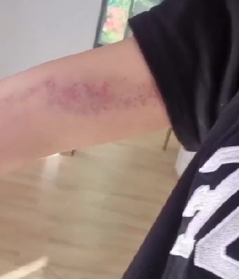 Уманский подрался на Доме 2, Безверхова отправилась в травмпункт