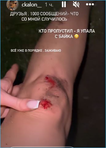 Выяснилось, чем разочарована Екатерина Скалон в праздники