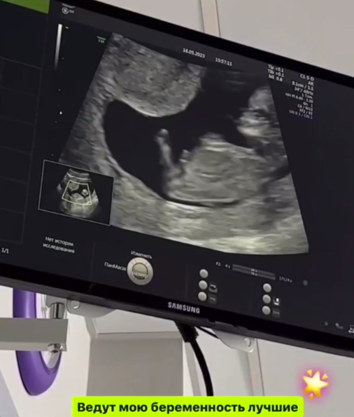 Переживающая из-за материнства Лиза Полыгалова узнала пол будущего ребёнка