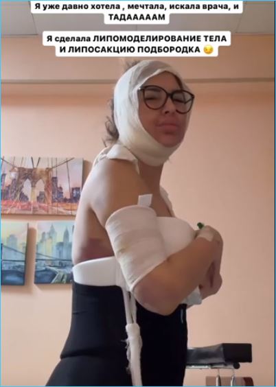 Майя Донцова устала бороться с лишним весом и решилась на пластическую операцию