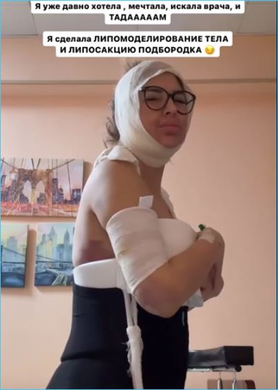 Майя Донцова устала бороться с лишним весом и решилась на пластическую операцию Майя Донцова устала бороться с лишним весом и решилась на пластическую операцию