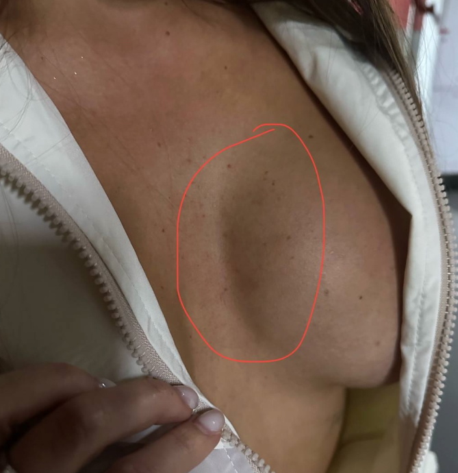 Евгения Дорожкина предъявила Мысиковой претензии за испорченные импланты