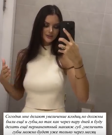 Анна Самонина увеличила ягодицы