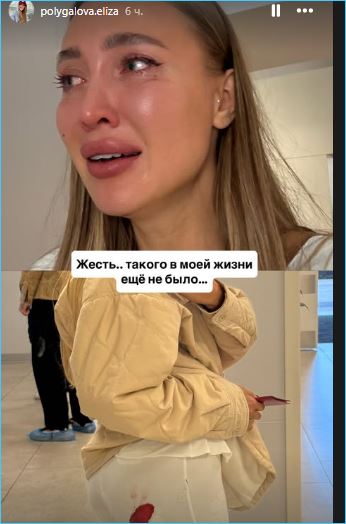 Такого в жизни еще не было, считает Елизавета Полыгалова, пострадавшая от укуса собаки