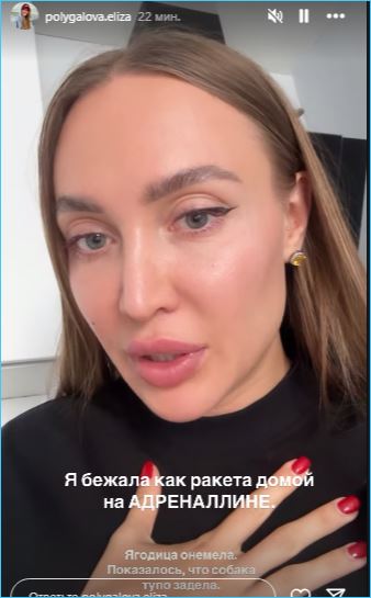 Такого в жизни еще не было, считает Елизавета Полыгалова, пострадавшая от укуса собаки