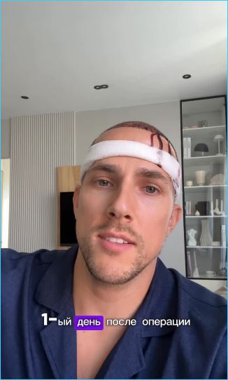 Федор Стрелков последовал примеру Арая Чобаняна и Иосифа Оганесяна в надежде вернуть шевелюру