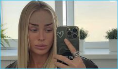 Кристина Лясковец очень довольна результатами своей пластической операции