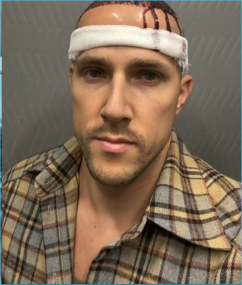 Федор Стрелков последовал примеру Арая Чобаняна и Иосифа Оганесяна в надежде вернуть шевелюру