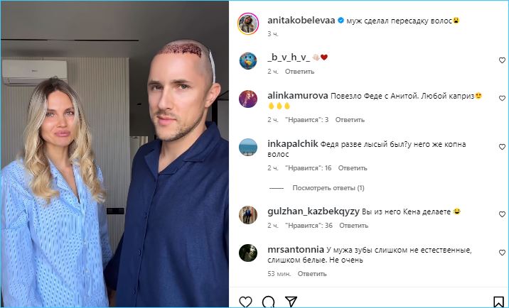 Федор Стрелков последовал примеру Арая Чобаняна и Иосифа Оганесяна в надежде вернуть шевелюру