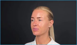 Кристина Лясковец решилась на комплексную пластическую операцию в Москве Кристина Лясковец решилась на комплексную пластическую операцию в Москве