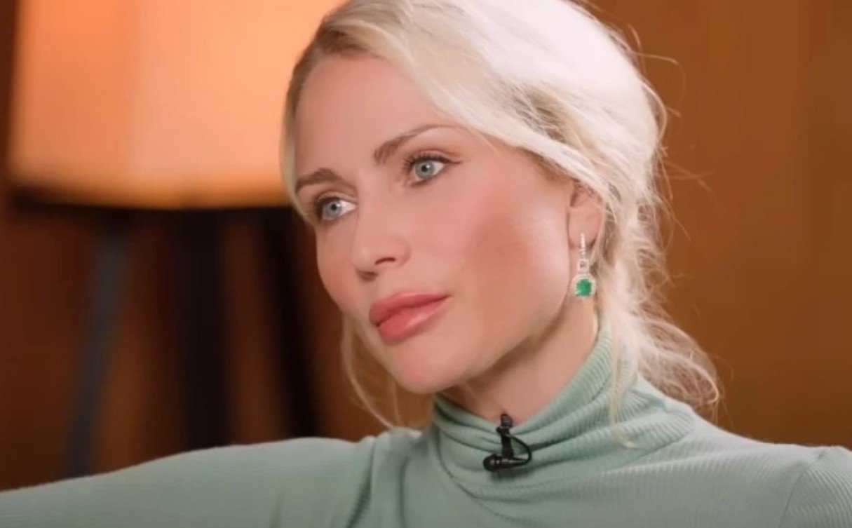 Екатерина Гордон прокомментировала синяки на лице жены Дмитрия Диброва