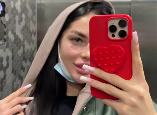 Даниил Сахнов разносит слухи о работе Кати Скалон в эскорте