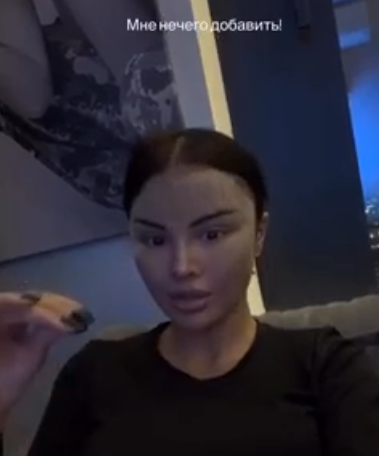 Яна Шафеева рассказала, какая операция превратила её в "китаянку"