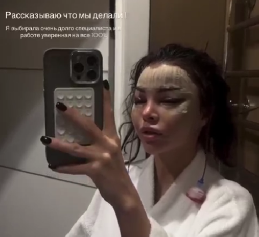 Яна Шафеева рассказала, какая операция превратила её в "китаянку"