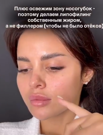 Яна Шафеева рассказала, какая операция превратила её в "китаянку"