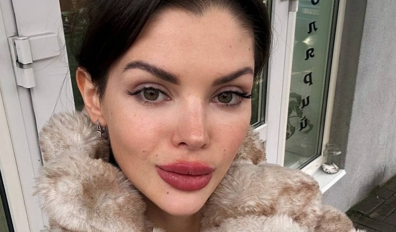 Анна Самонина обещала подписчикам не "качать" губы