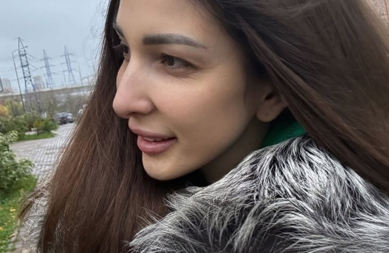 Яна Захарова сделала блефаропластику