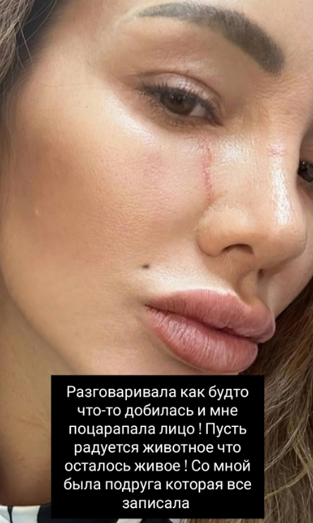 Клавдия Безверхова объяснила, почему расцарапала лицо мамы и прекратила общаться