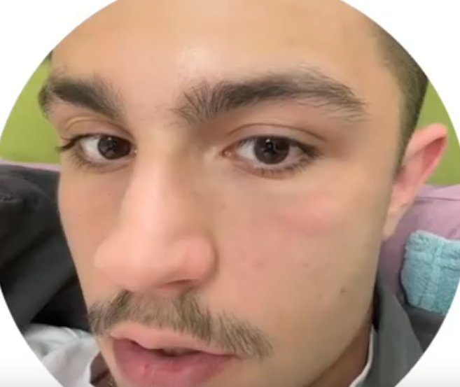 Никита Гуранда подозревает, что у него проблемы с почками Никита Гуранда подозревает, что у него проблемы с почками