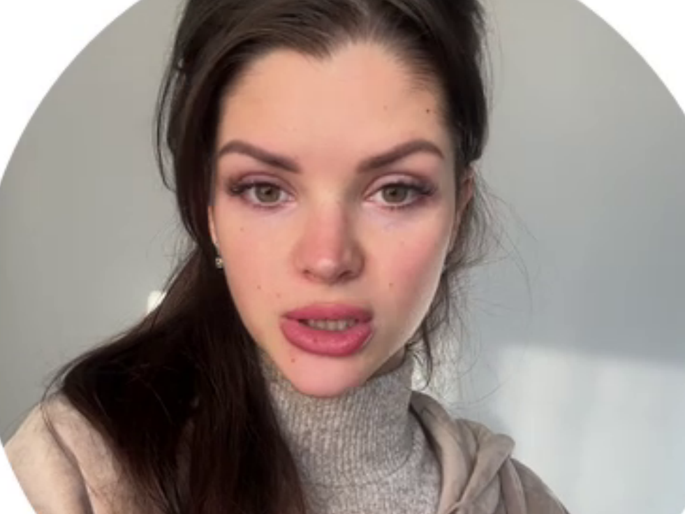 Анна Самонина пытается лечить аллергию у дочки без врача Анна Самонина пытается лечить аллергию у дочки без врача