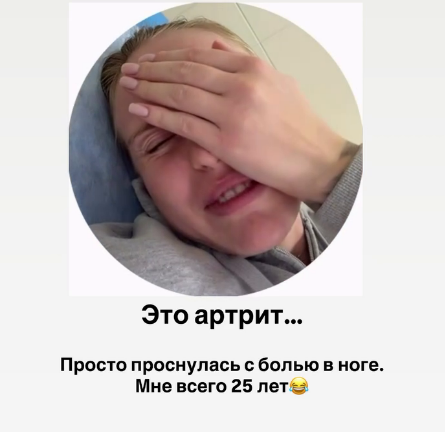 25-летняя Милена Безбородова пожаловалась на артрит