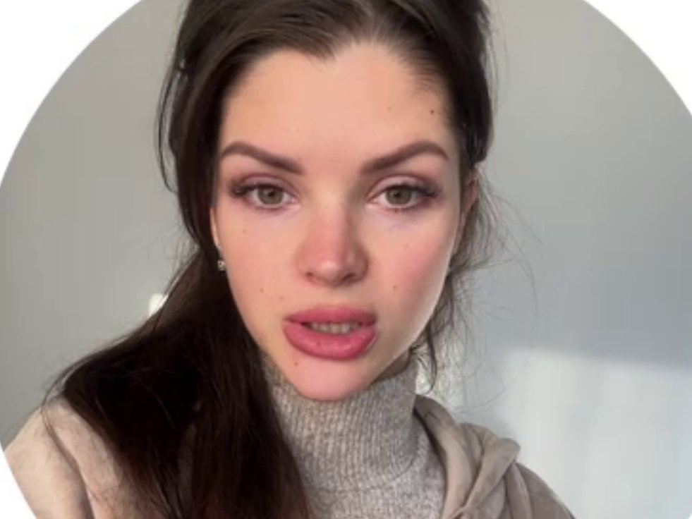 Анна Самонина пытается лечить аллергию у дочки без врача