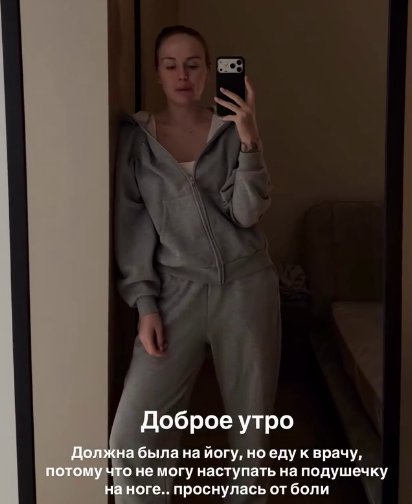 25-летняя Милена Безбородова пожаловалась на артрит