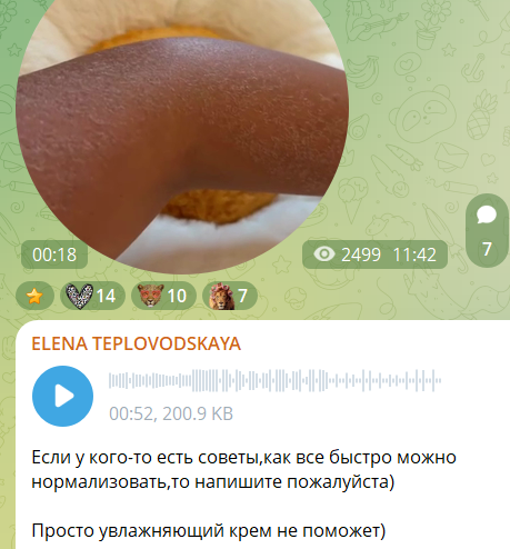 У Елены Тепловодской произошло ЧП перед важными съемками