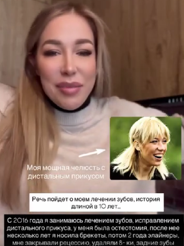 Надежда Ермакова исполнила свою мечту - улыбка на 1 млн рублей почти готова