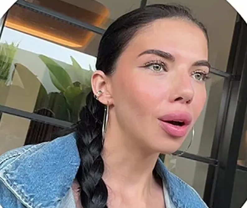 Ирина Пингвинова получила травмы после падения с байка на Бали