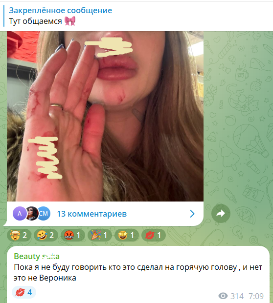 Ксения Карпова попала под горячую руку и получила в нос
