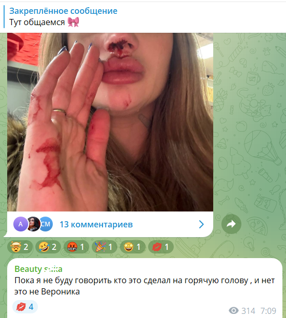 Ксения Карпова попала под горячую руку и получила в нос