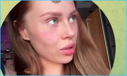 Екатерина Горина рассказала о сложности восстановления после пластики тела