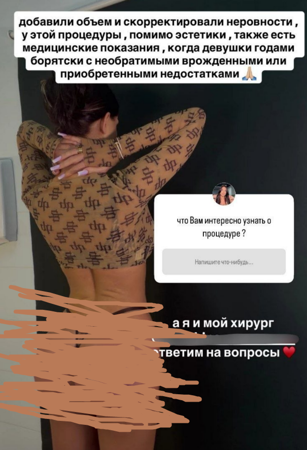 Зрители Дома 2 шокированы тем, что сделала с собой Катя Скалон