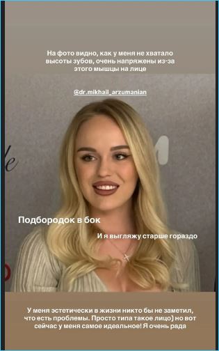 Милена Безбородова жалуется на заниженную самооценку