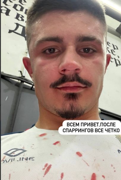 Никита Гуранда пострадал на подготовке к соревнованиям