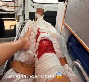 Ольгу Бузову госпитализировали из-за травмы колена