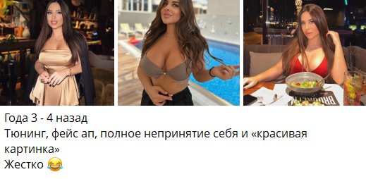 Евгения Хорошева не принимала себя, пока не сделала операции